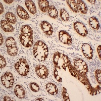 Anti-Cytokeratin 19 Antibody