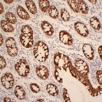 Cytokeratin 19 antibody