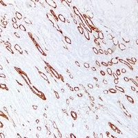 Cytokeratin 19 antibody