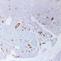 Cytokeratin 19 antibody