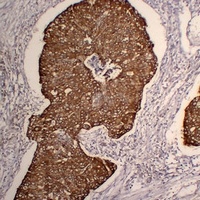 Anti-Cytokeratin 5 Antibody