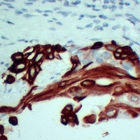 Cytokeratin 5 antibody