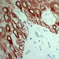 Anti-Cytokeratin 5 Antibody