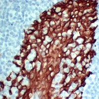Cytokeratin 5 antibody