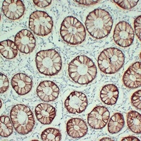 Anti-Claudin 4 Antibody