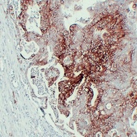 GLUT1 Mouse Monoclonal Antibody