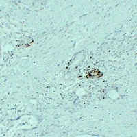IGF2 Mouse Monoclonal Antibody