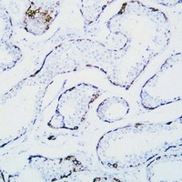 MAGEC1 antibody