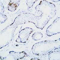 Anti-MAGEC1 Antibody