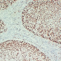 MCM2 Antibody