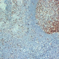 MCM2 antibody