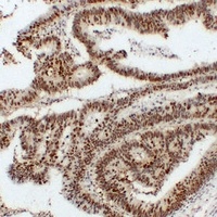 Nucleophosmin antibody