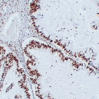 Nucleophosmin antibody
