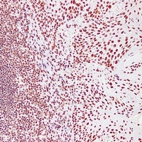 Anti-Nucleophosmin Antibody