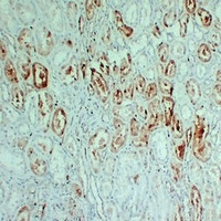 S100-A1 Mouse Monoclonal Antibody