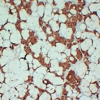 Anti-S100-A1 Antibody