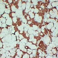 S100-A1 antibody