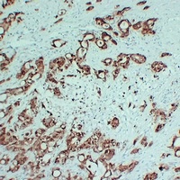 S100-P Antibody