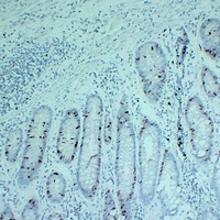 Topoisomerase 2 alpha Antibody