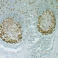 Topoisomerase 2 alpha Antibody
