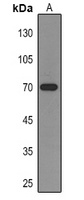ZAP70 Mouse Monoclonal Antibody