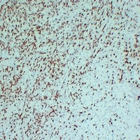 ZAP70 Mouse Monoclonal Antibody