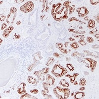 AMACR Mouse Monoclonal Antibody