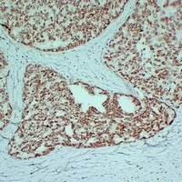 Androgen Receptor Mouse Monoclonal Antibody