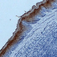 Anti-Annexin A1 Antibody