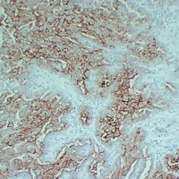 Anti-MUC16 Antibody