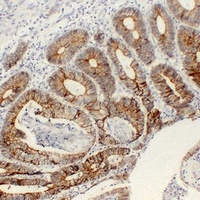 Anti-Cadherin pan Antibody