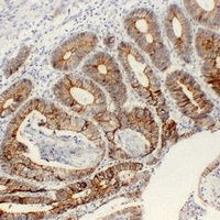 Cadherin pan antibody