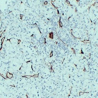 Anti-CD105 Antibody