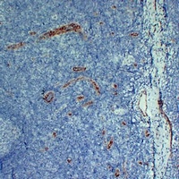 Anti-CD105 Antibody