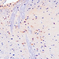 Chromogranin A antibody