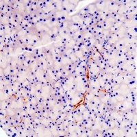 Chromogranin A antibody