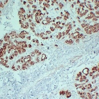 Claudin 4 antibody