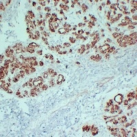 Claudin 4 Antibody