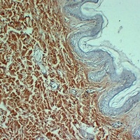 Collagen 3 alpha 1 Antibody
