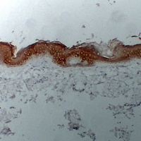 Cytokeratin 1 Mouse Monoclonal Antibody