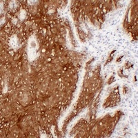 Cytokeratin 16 Mouse Monoclonal Antibody