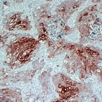 Cytokeratin 17 Mouse Monoclonal Antibody