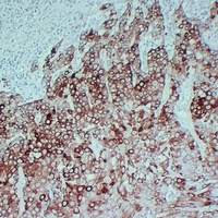 Cytokeratin 17 Mouse Monoclonal Antibody
