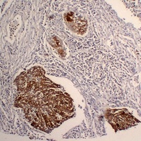 Anti-Cytokeratin 5 Antibody