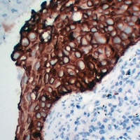 Anti-Cytokeratin 5 Antibody