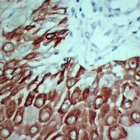 Anti-Cytokeratin 5 Antibody
