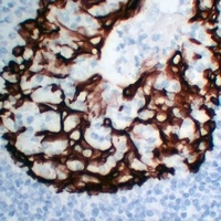 Anti-Cytokeratin 5 Antibody