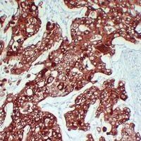 Cytokeratin 6 Mouse Monoclonal Antibody