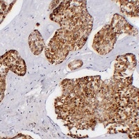 Cytokeratin 7 Mouse Monoclonal Antibody