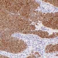 Cytokeratin 7 Mouse Monoclonal Antibody